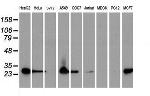 SPR Antibody in Western Blot (WB)