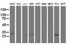 SPR Antibody in Western Blot (WB)