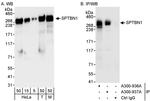 SPTBN1 Antibody in Western Blot (WB)