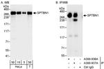 SPTBN1 Antibody in Western Blot (WB)