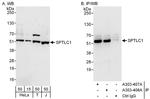 SPTLC1 Antibody in Western Blot (WB)