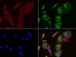 SQSTM1 Antibody in Immunocytochemistry (ICC/IF)