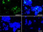 SQSTM1 Antibody in Immunocytochemistry (ICC/IF)