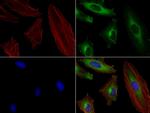 SQSTM1 Antibody in Immunocytochemistry (ICC/IF)