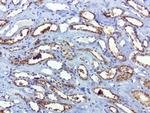 SQSTM1 Antibody in Immunohistochemistry (Paraffin) (IHC (P))