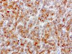 SQSTM1 Antibody in Immunohistochemistry (Paraffin) (IHC (P))