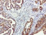 SQSTM1 Antibody in Immunohistochemistry (Paraffin) (IHC (P))