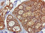 SQSTM1 Antibody in Immunohistochemistry (Paraffin) (IHC (P))