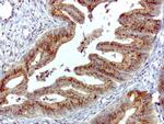 SQSTM1 Antibody in Immunohistochemistry (Paraffin) (IHC (P))