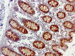 SQSTM1 Antibody in Immunohistochemistry (Paraffin) (IHC (P))