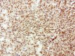 SQSTM1 Antibody in Immunohistochemistry (Paraffin) (IHC (P))