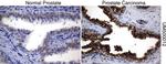 SQSTM1 Antibody in Immunohistochemistry (Paraffin) (IHC (P))