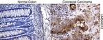 SQSTM1 Antibody in Immunohistochemistry (Paraffin) (IHC (P))