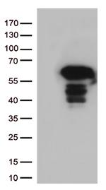 SQSTM1 Antibody in Western Blot (WB)