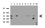 SQSTM1 Antibody in Western Blot (WB)