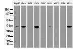 SQSTM1 Antibody in Western Blot (WB)