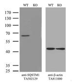 SQSTM1 Antibody in Western Blot (WB)