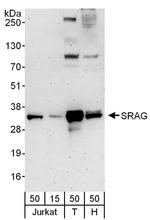 SRAG Antibody in Western Blot (WB)