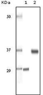 SRA1 Antibody in Western Blot (WB)