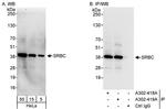 SRBC Antibody in Western Blot (WB)