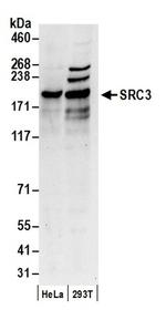 SRC3 Antibody in Western Blot (WB)