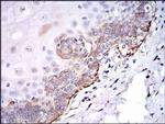 SRC Antibody in Immunohistochemistry (Paraffin) (IHC (P))