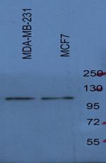 SREBP1 Antibody in Western Blot (WB)