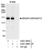 SRGAP1/ARHGAP13 Antibody in Immunoprecipitation (IP)