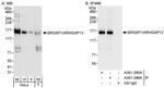 SRGAP1/ARHGAP13 Antibody in Western Blot (WB)