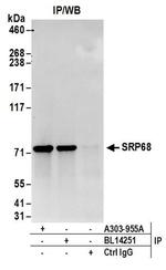 SRP68 Antibody in Western Blot (WB)