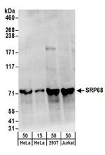 SRP68 Antibody in Western Blot (WB)