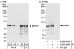 SRPK1 Antibody in Western Blot (WB)