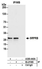 SRPRB Antibody in Western Blot (WB)