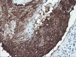 SRPRB Antibody in Immunohistochemistry (Paraffin) (IHC (P))