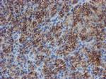 SRPRB Antibody in Immunohistochemistry (Paraffin) (IHC (P))