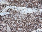 SRPRB Antibody in Immunohistochemistry (Paraffin) (IHC (P))