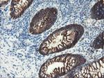 SRPRB Antibody in Immunohistochemistry (Paraffin) (IHC (P))