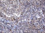 SRPRB Antibody in Immunohistochemistry (Paraffin) (IHC (P))