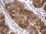 SRPRB Antibody in Immunohistochemistry (Paraffin) (IHC (P))