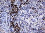 SRPRB Antibody in Immunohistochemistry (Paraffin) (IHC (P))