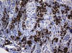 SRPRB Antibody in Immunohistochemistry (Paraffin) (IHC (P))