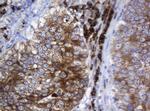 SRPRB Antibody in Immunohistochemistry (Paraffin) (IHC (P))