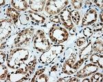 SRR Antibody in Immunohistochemistry (Paraffin) (IHC (P))