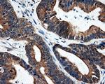 SRR Antibody in Immunohistochemistry (Paraffin) (IHC (P))