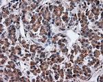 SRR Antibody in Immunohistochemistry (Paraffin) (IHC (P))