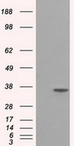 SRR Antibody in Western Blot (WB)