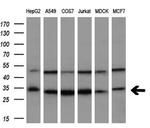 SRR Antibody in Western Blot (WB)