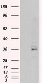 SRR Antibody in Western Blot (WB)