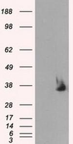 SRR Antibody in Western Blot (WB)