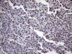 SRSF9 Antibody in Immunohistochemistry (Paraffin) (IHC (P))